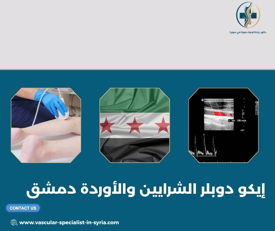 إيكو دوبلر الشرايين والأوردة دمشق إيكو دوبلر الشرايين والأوردة دمشق