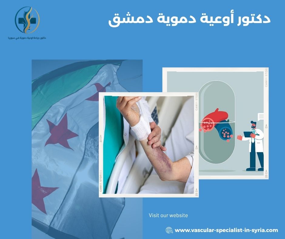 دكتور أوعية دموية دمشق دكتور أوعية دموية دمشق
