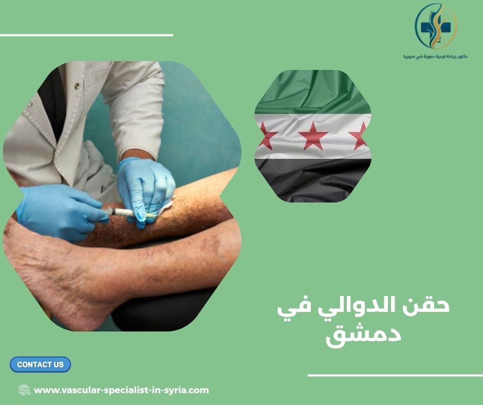 تعليمات المتابعة بعد حقن الدوالي