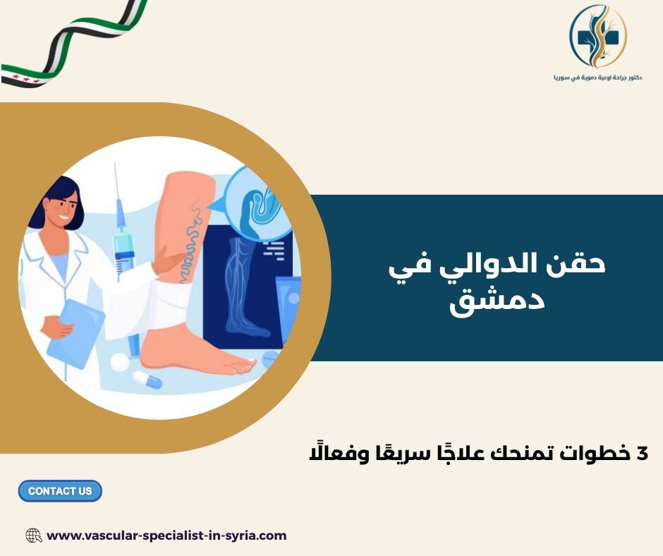 حقن الدوالي في دمشق