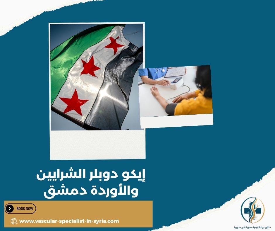 كيف تستعد لفحص إيكو دوبلر الشرايين والأوردة دمشق؟ كيف تستعد لفحص إيكو دوبلر الشرايين والأوردة دمشق؟