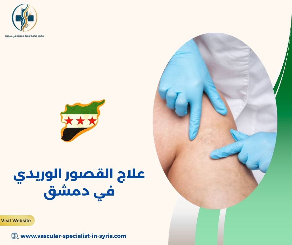 متى يحتاج القصور الوريدي إلى تقييم متخصص؟ متى يحتاج القصور الوريدي إلى تقييم متخصص؟