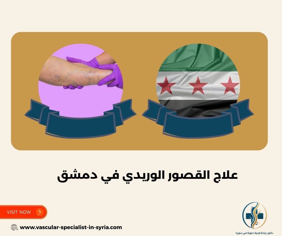 علاج القصور الوريدي في دمشق علاج القصور الوريدي في دمشق
