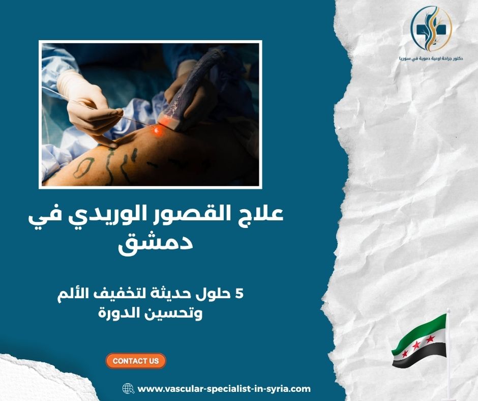 علاج القصور الوريدي في دمشق