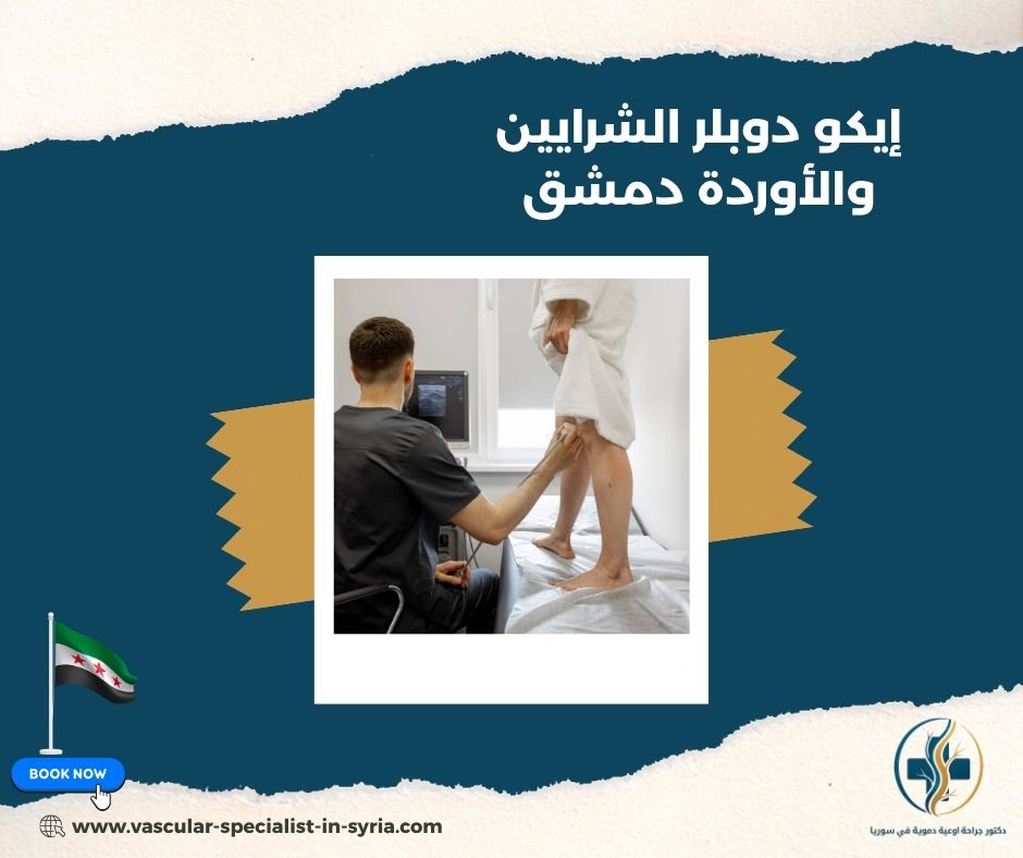 إيكو دوبلر الشرايين والأوردة دمشق إيكو دوبلر الشرايين والأوردة دمشق