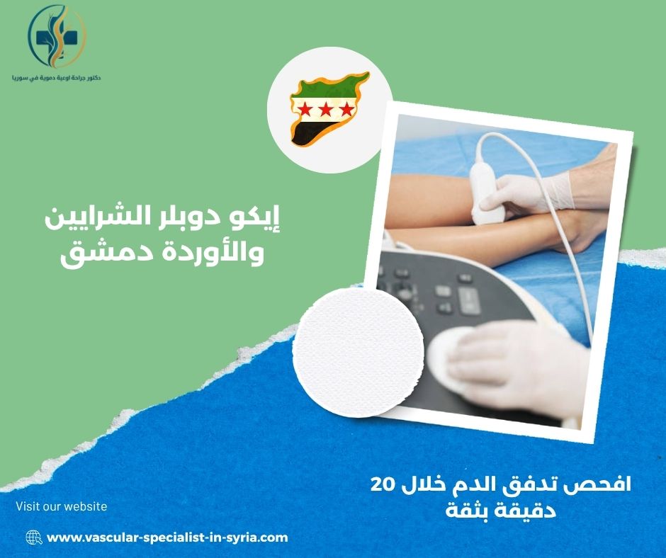 إيكو دوبلر الشرايين والأوردة دمشق