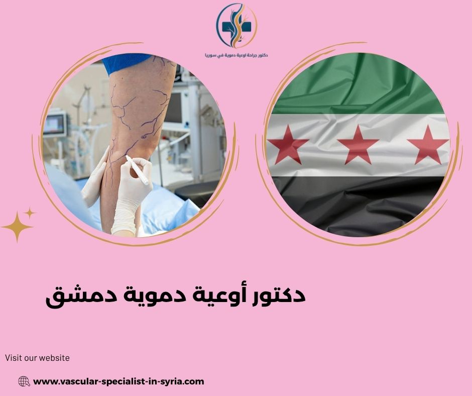 هل الدوالي تسبب ألماً وثقلاً في الساق؟ هل الدوالي تسبب ألماً وثقلاً في الساق؟