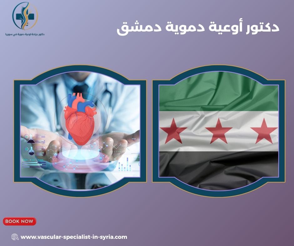 دكتور أوعية دموية دمشق دكتور أوعية دموية دمشق