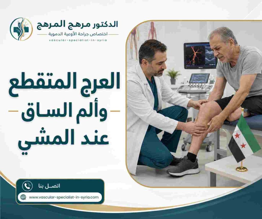 العرج المتقطع وألم الساق عند المشي العرج المتقطع وألم الساق عند المشي