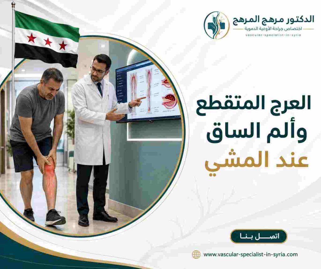 العرج المتقطع وألم الساق عند المشي العرج المتقطع وألم الساق عند المشي