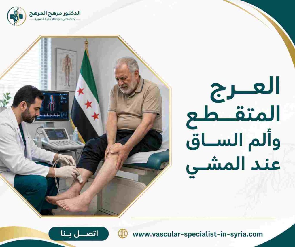 العرج المتقطع وألم الساق عند المشي العرج المتقطع وألم الساق عند المشي