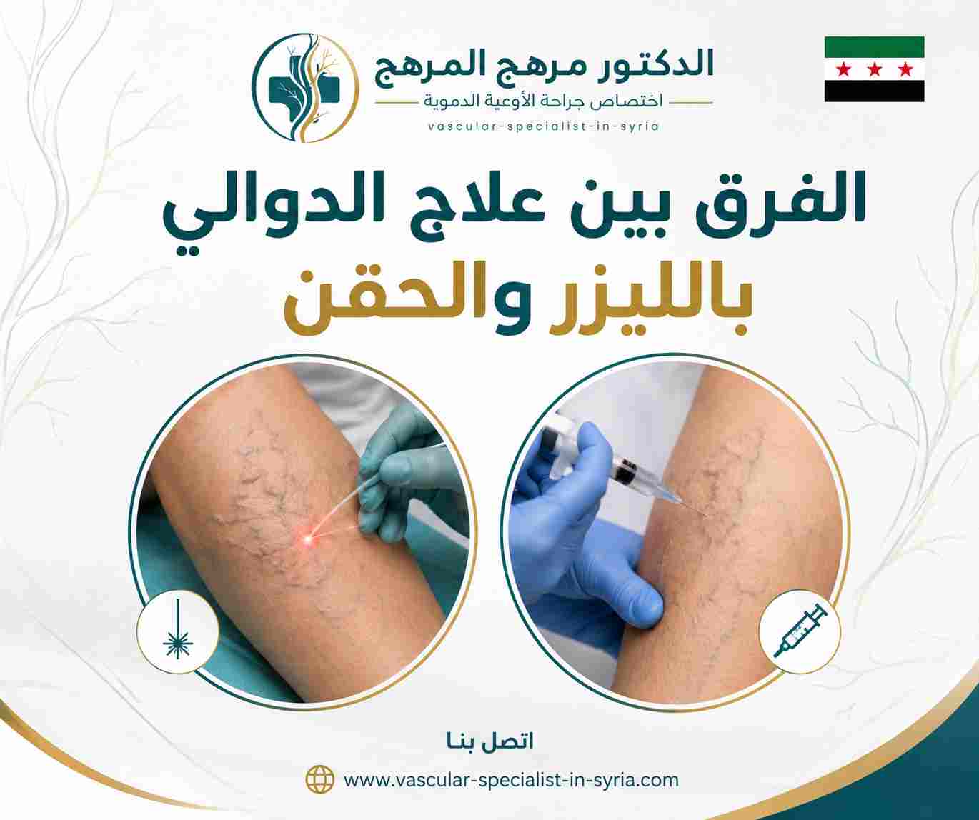 الفرق بين علاج الدوالي بالليزر والحقن الفرق بين علاج الدوالي بالليزر والحقن