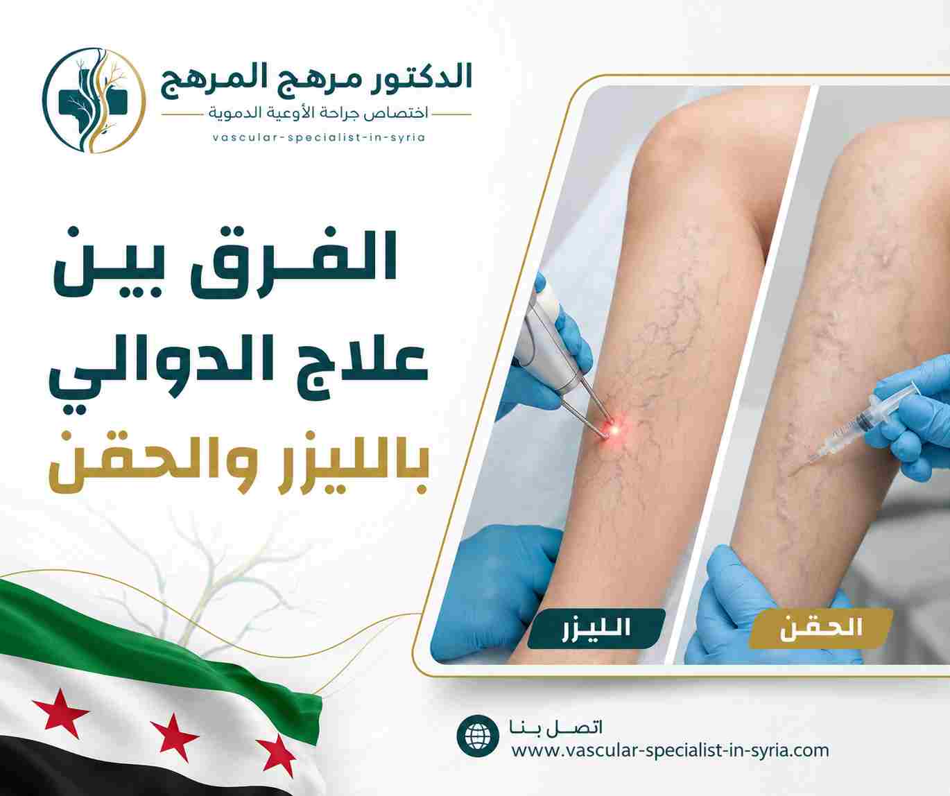 الفرق بين علاج الدوالي بالليزر والحقن الفرق بين علاج الدوالي بالليزر والحقن