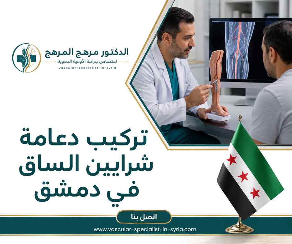 تركيب دعامة شرايين الساق في دمشق تركيب دعامة شرايين الساق في دمشق