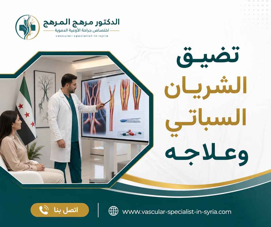تضيق الشريان السباتي وعلاجه تضيق الشريان السباتي وعلاجه