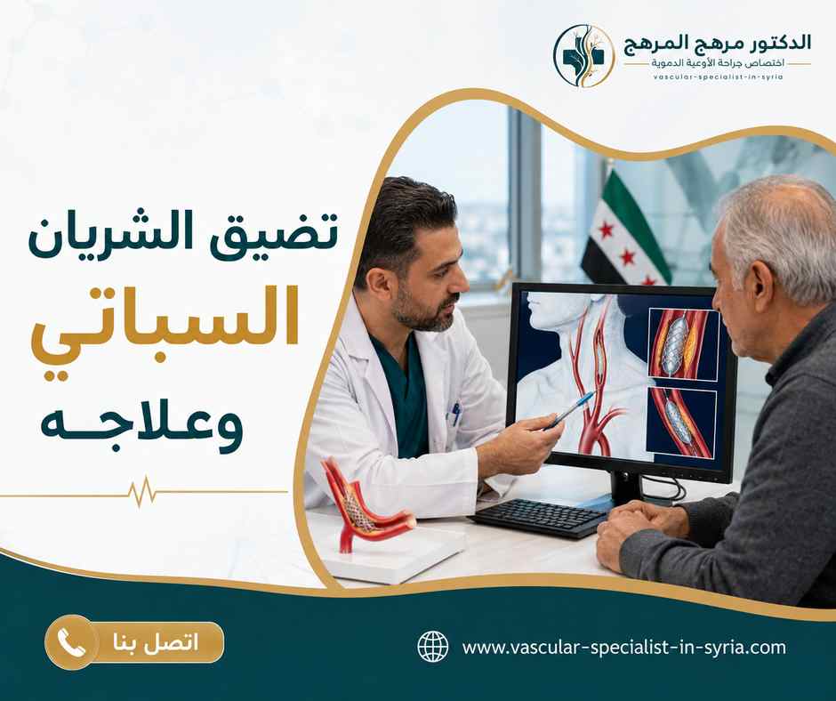 تضيق الشريان السباتي وعلاجه تضيق الشريان السباتي وعلاجه