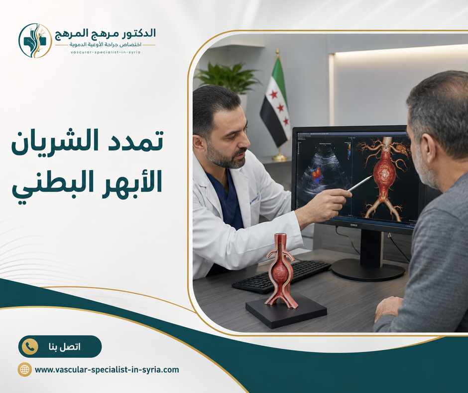 تمدد الشريان الأبهر البطني تمدد الشريان الأبهر البطني