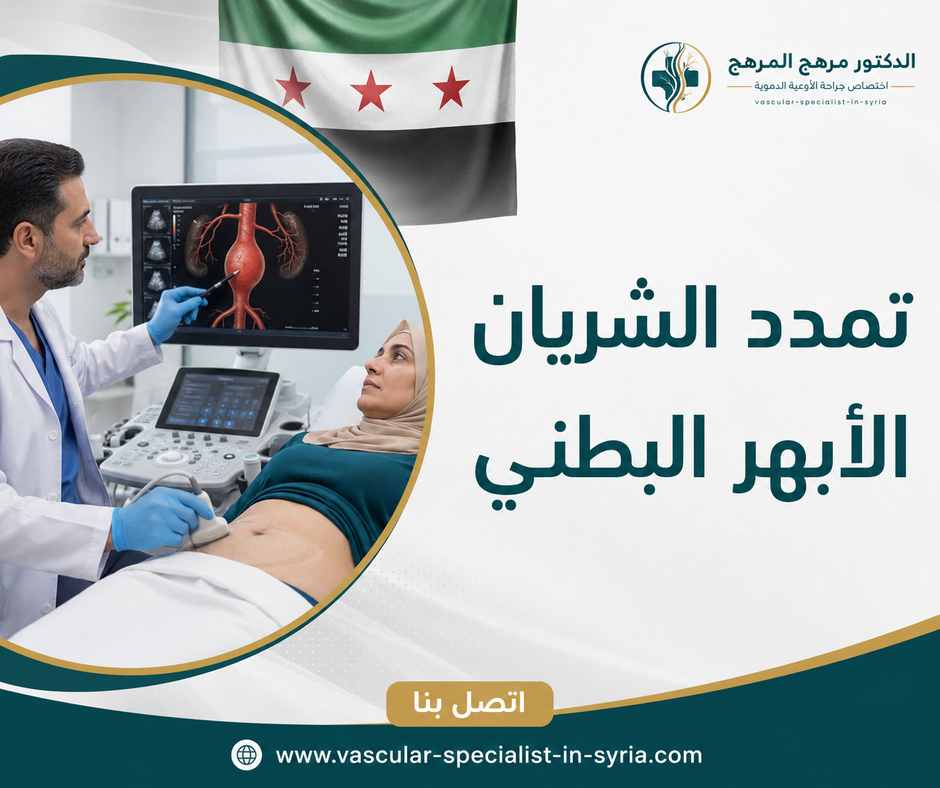 تمدد الشريان الأبهر البطني تمدد الشريان الأبهر البطني