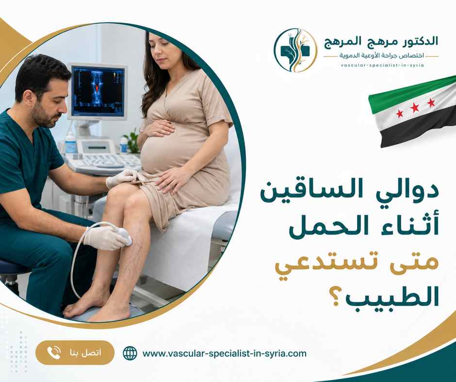 دوالي الساقين أثناء الحمل متى تستدعي الطبيب؟