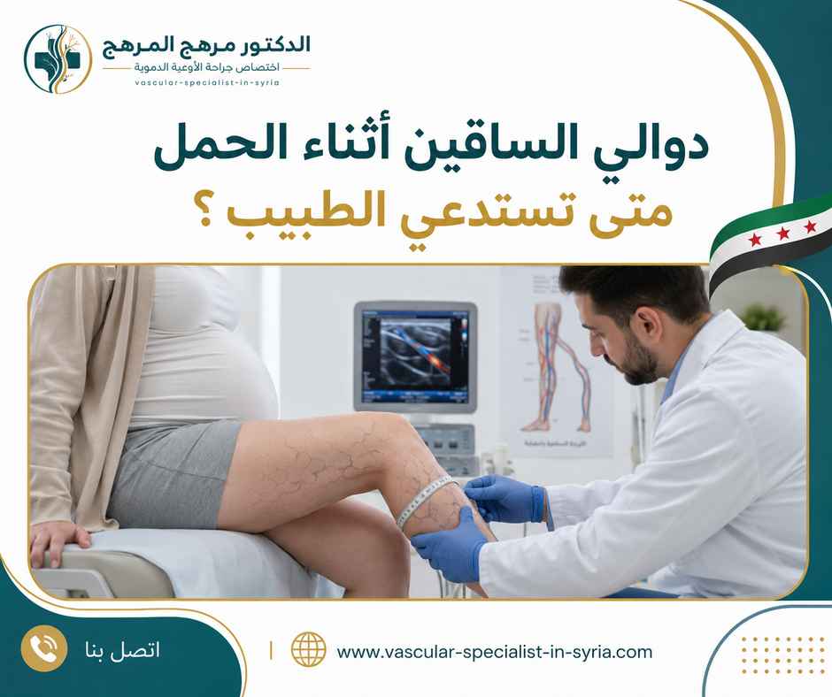 دوالي الساقين أثناء الحمل متى تستدعي الطبيب؟