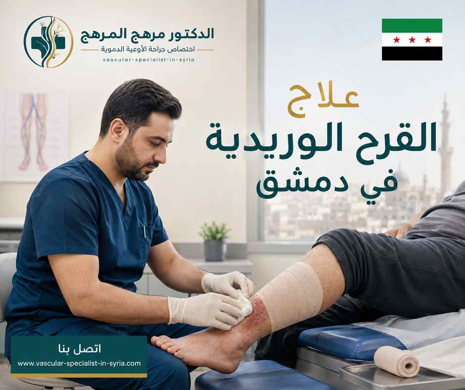 علاج القرح الوريدية في دمشق علاج القرح الوريدية في دمشق