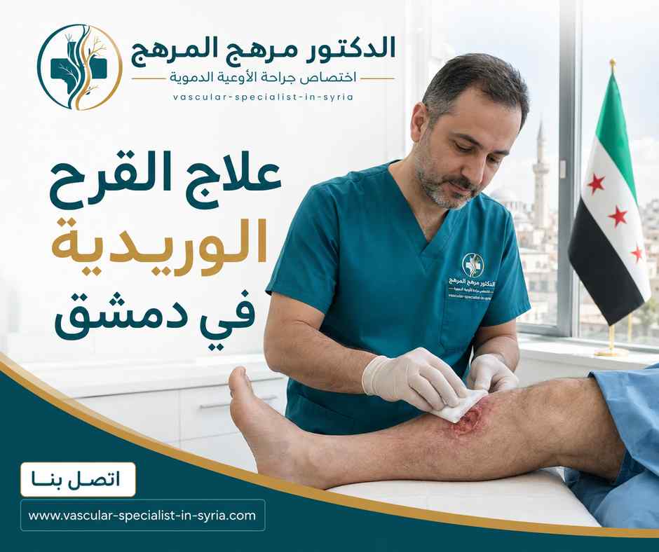علاج القرح الوريدية في دمشق علاج القرح الوريدية في دمشق