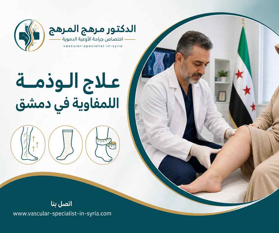 علاج الوذمة اللمفاوية في دمشق علاج الوذمة اللمفاوية في دمشق