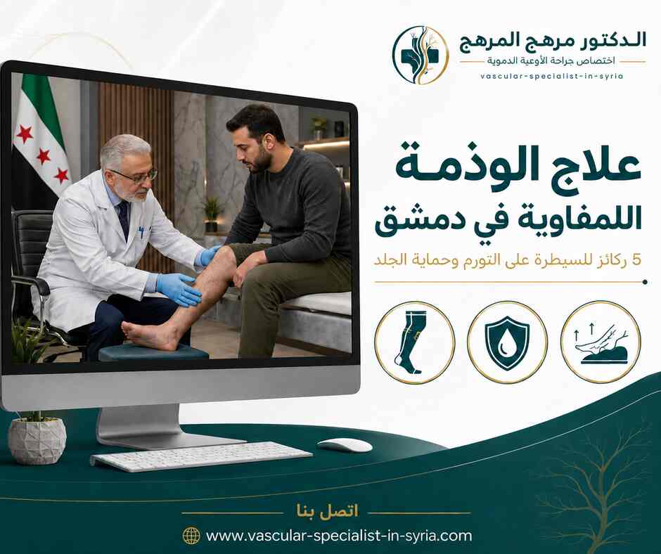 علاج الوذمة اللمفاوية في دمشق