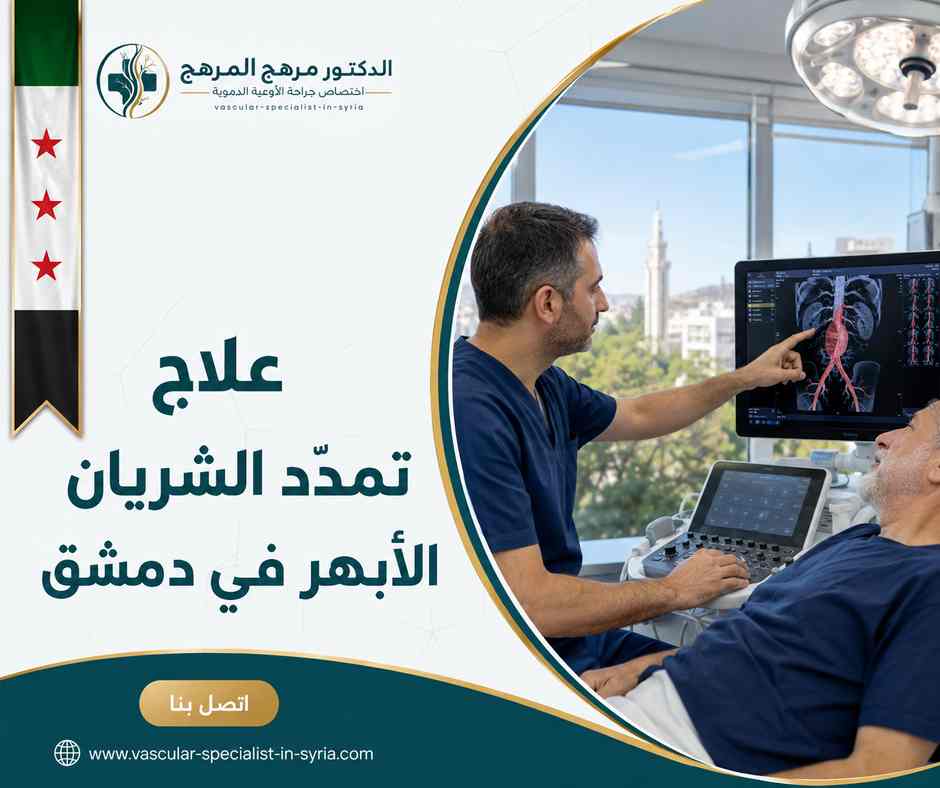علاج تمدد الشريان الأبهر في دمشق علاج تمدد الشريان الأبهر في دمشق