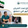 علاج تمدد الشريان الأبهر في دمشق