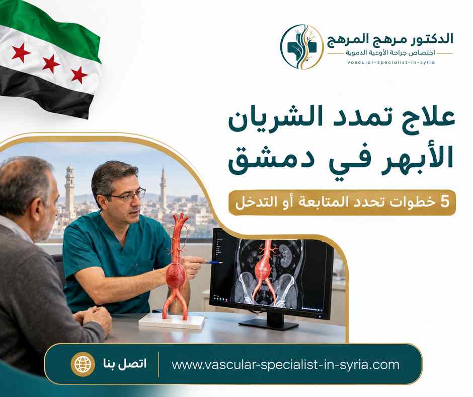 علاج تمدد الشريان الأبهر في دمشق