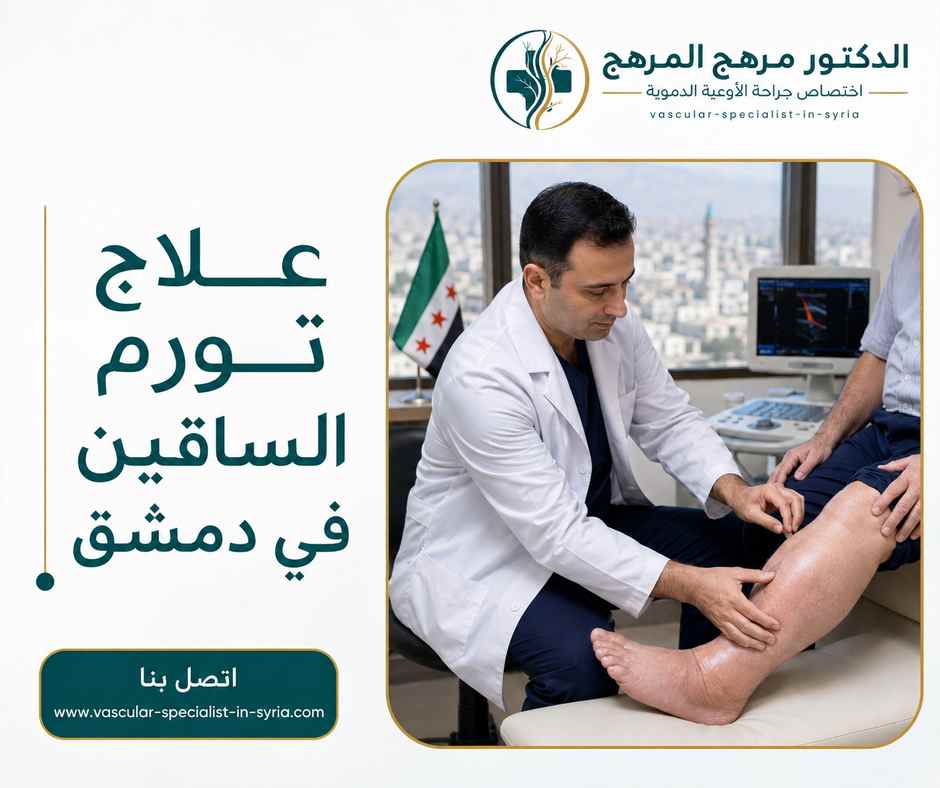 علاج تورم الساقين في دمشق علاج تورم الساقين في دمشق