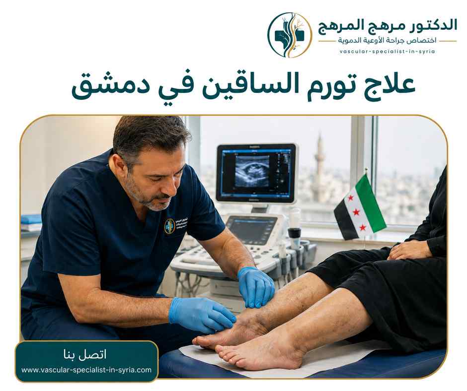 علاج تورم الساقين في دمشق علاج تورم الساقين في دمشق