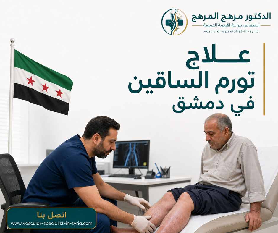علاج تورم الساقين في دمشق علاج تورم الساقين في دمشق