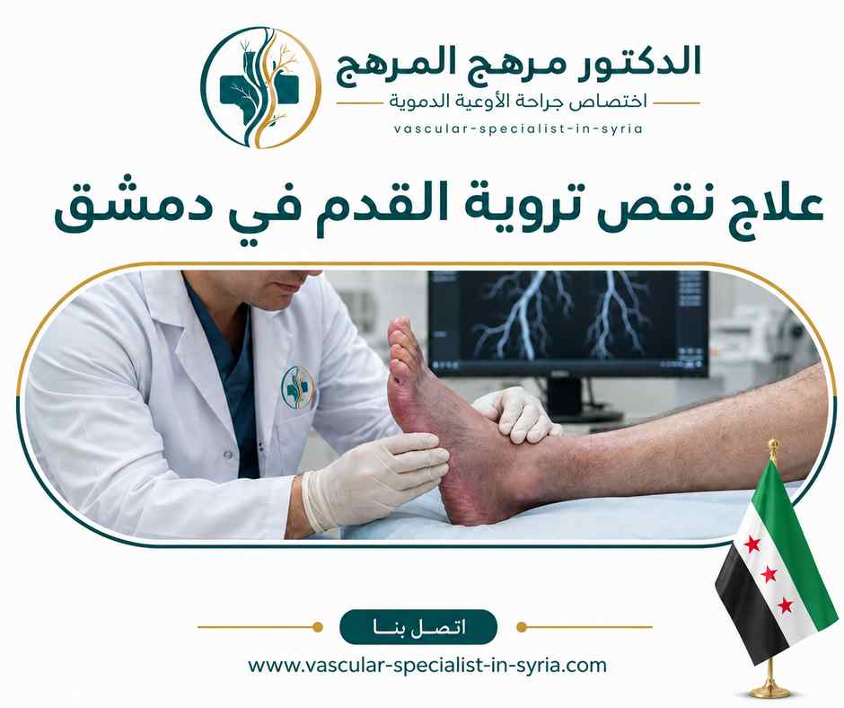علاج نقص تروية القدم في دمشق علاج نقص تروية القدم في دمشق
