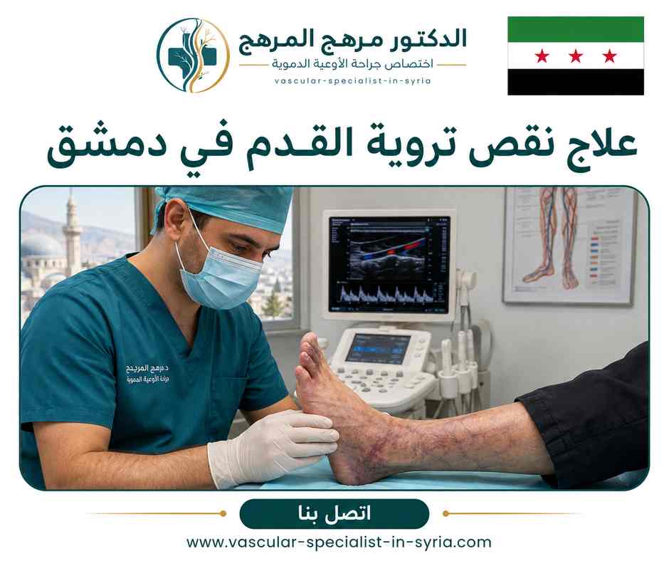 علاج نقص تروية القدم في دمشق علاج نقص تروية القدم في دمشق