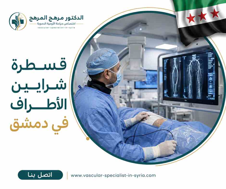 قسطرة شرايين الأطراف في دمشق قسطرة شرايين الأطراف في دمشق