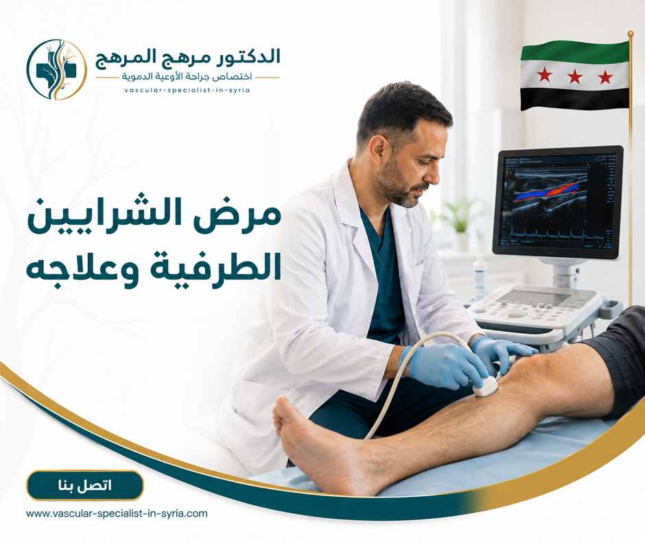 مرض الشرايين الطرفية وعلاجه مرض الشرايين الطرفية وعلاجه