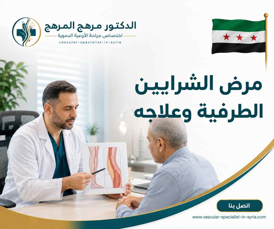 مرض الشرايين الطرفية وعلاجه مرض الشرايين الطرفية وعلاجه