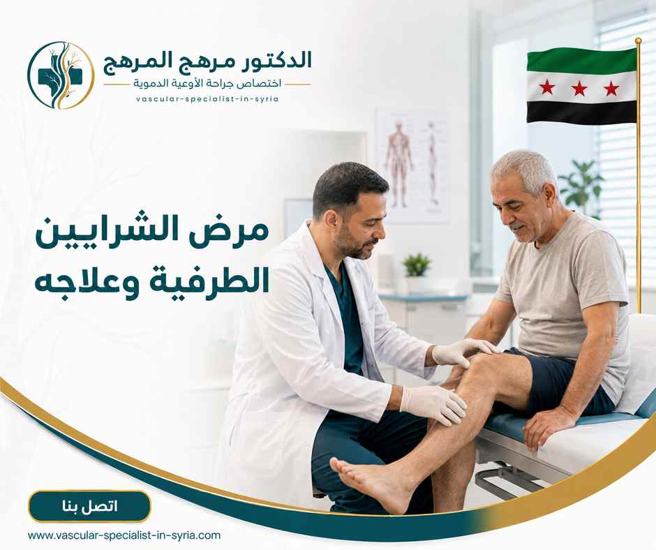 مرض الشرايين الطرفية وعلاجه مرض الشرايين الطرفية وعلاجه